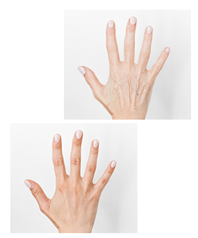 cosmetic device